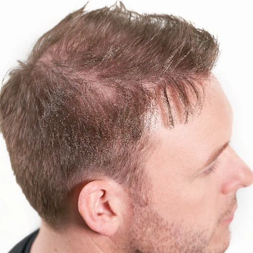 Poudre cheveux kératine camouflage cheveux fins Nanofibres