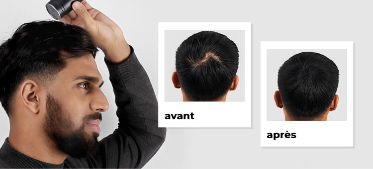 Poudre kératine Nanogen camouflage chute de cheveux