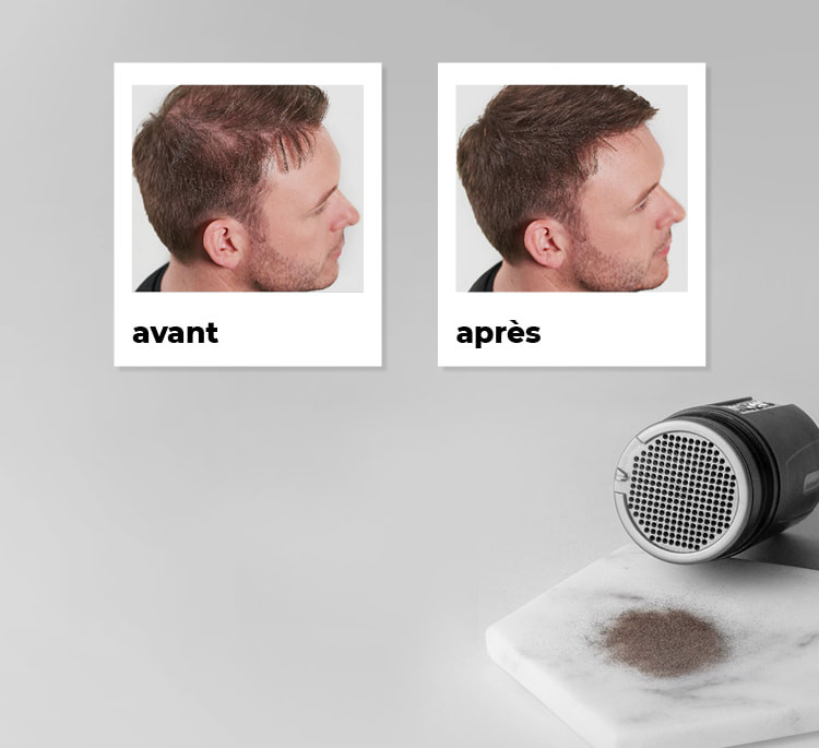 Poudre de kératine densifiante cheveux clairsemés Nanogen